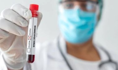 OMS declara varíola dos macacos como emergência sanitária global